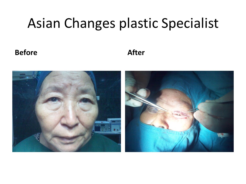 Asian Changes