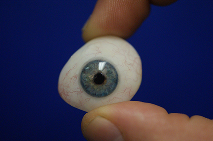 Ocular Prosthesis | Decure Center